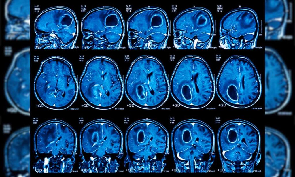 Medical Imaging